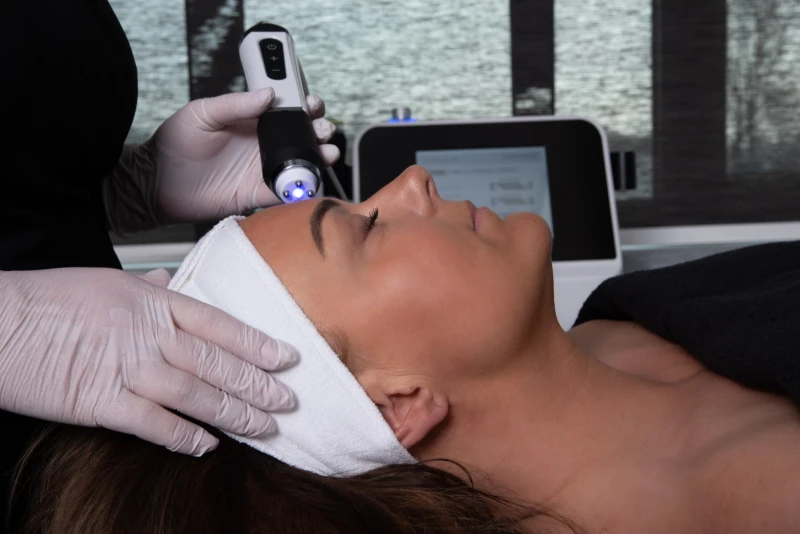Pigmentvlekken verwijderen met laser in Leiden